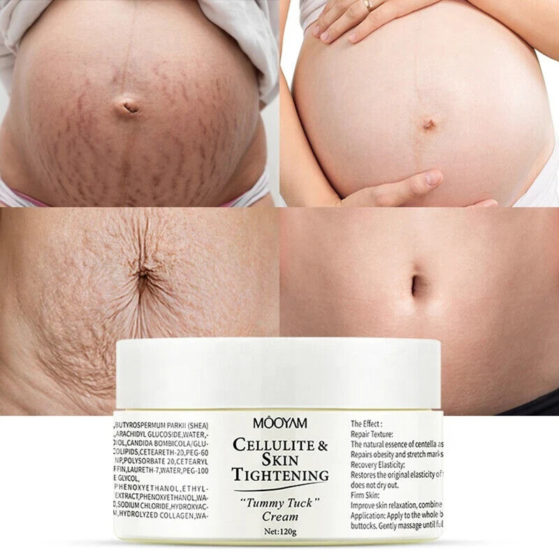 Mooyam Cellulite and Skin Tightening